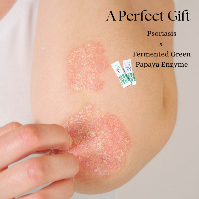 Why Fermented Green Papaya Enzyme Makes the Perfect Gift for Skin Care Enthusiasts with Psoriasis